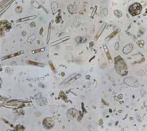 Bakterier i ett mikroskop, osynliga för blotta ögat. Bild av Yersinia Pestis.